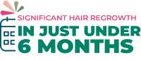 Some patients taking Litfulo ™ (ritlecitinib) saw significant hair regrowth in just under 6 months. See safety info.